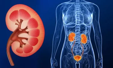 penyebab gagal ginjal